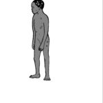 CD13 Ringworm c